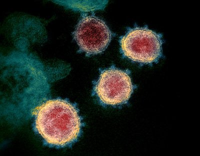 1200px-novel-coronavirus-sars-cov-2.jpg